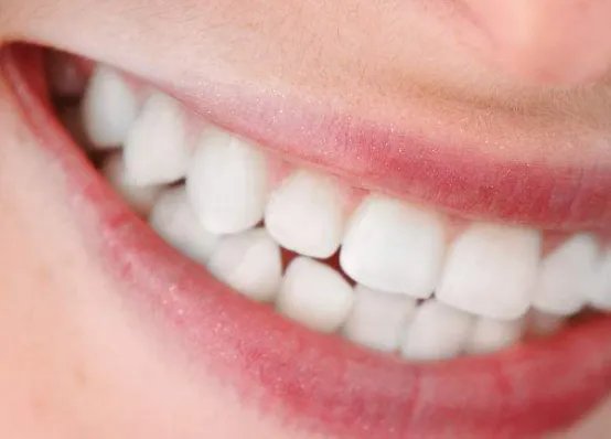 矫正牙齿要多少钱