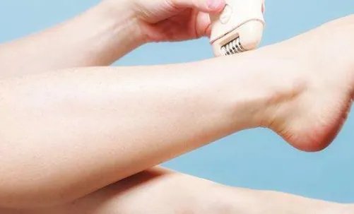 激光脱毛有副作用吗