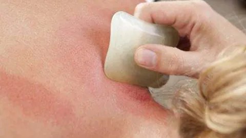 刮痧方法正确的步骤是什么