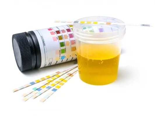 早孕试纸什么时候用