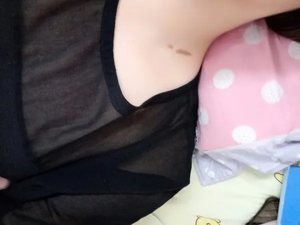 解读锁骨下有胎记的女人命运，好不好、代表什么看看就知道