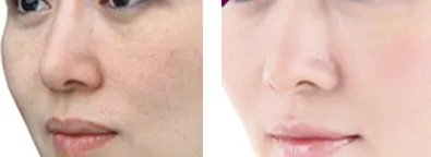 有关皮肤的知识介绍 