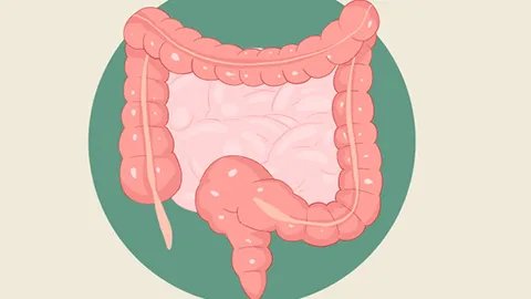 乙状结肠冗长症状