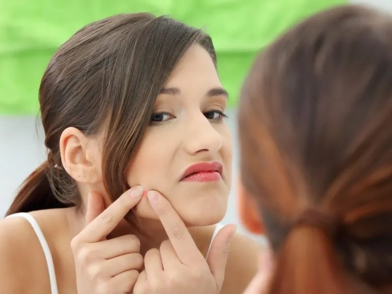 脸上长痤疮怎么办