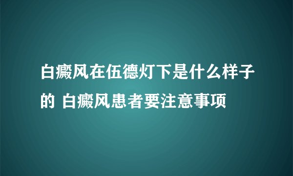 白癜风在伍德灯下是什么样子的 白癜风患者要注意事项