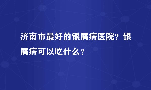 济南市最好的银屑病医院？银屑病可以吃什么？