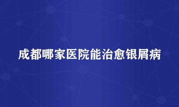 成都哪家医院能治愈银屑病