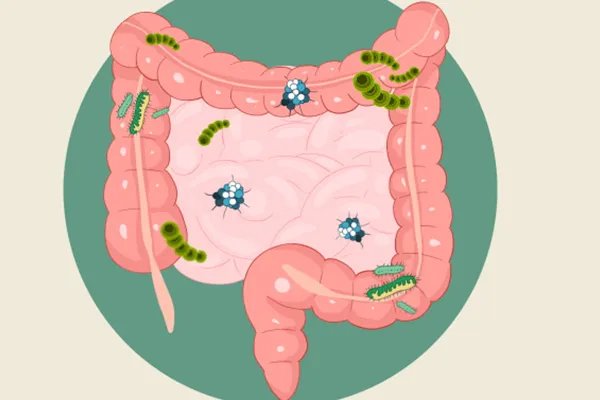 肠炎患者吃什么食物好