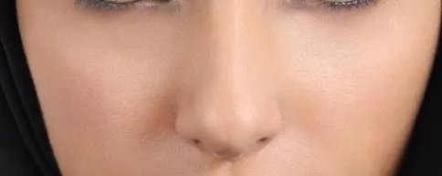 去红血丝用多少钱