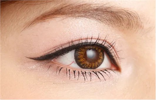 开眼角割双眼皮价钱