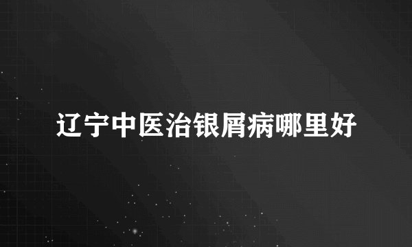 辽宁中医治银屑病哪里好