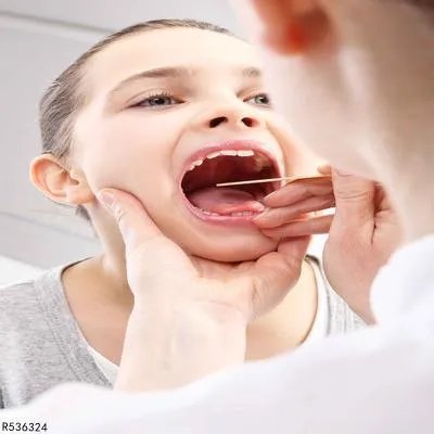 牙膏能治疗口角炎吗 治疗口角炎小技巧你都掌握了吗