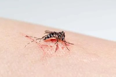 蚊虫叮咬怎么快速止痒