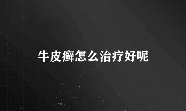牛皮癣怎么治疗好呢