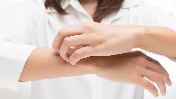 皮肤瘙痒怎么办