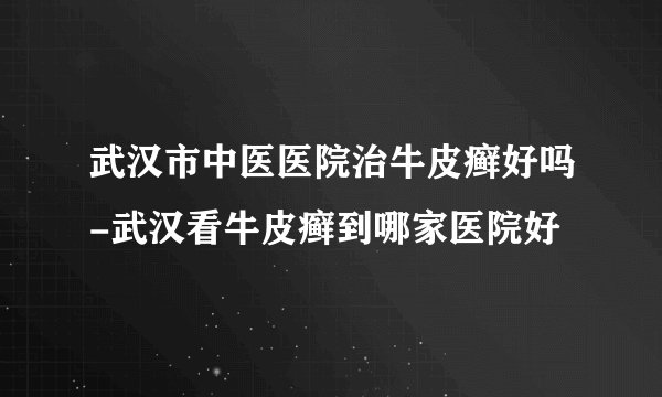 武汉市中医医院治牛皮癣好吗-武汉看牛皮癣到哪家医院好
