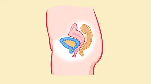 乙状结肠冗长症状