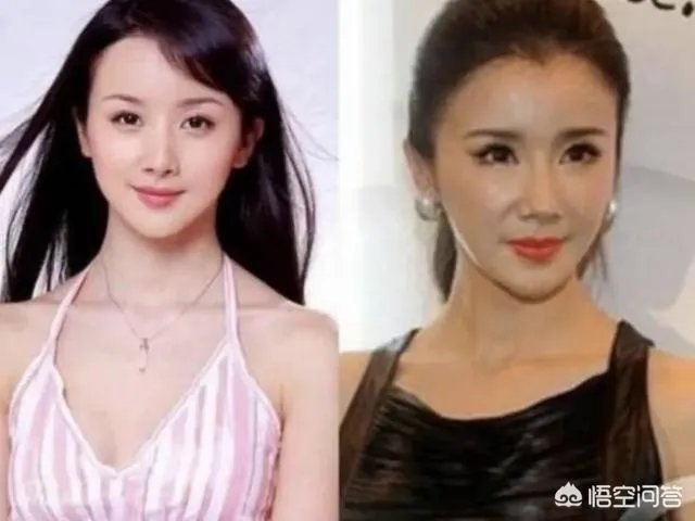 有哪些整容失败的明星？