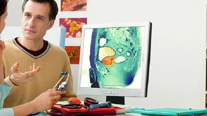 X综合征如何预防？