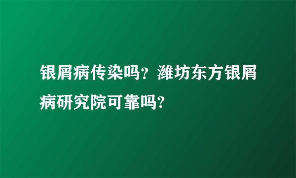 银屑病传染吗？潍坊东方银屑病研究院可靠吗?
