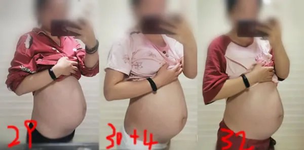 怀孕1一9月肚子变化图过程