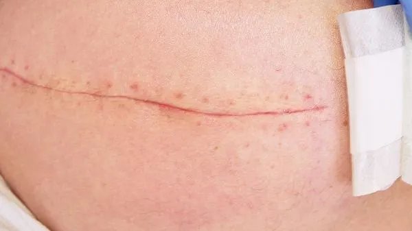 84消毒液和洁厕灵混合有毒吗