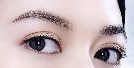 小眼睛可以整容变大吗