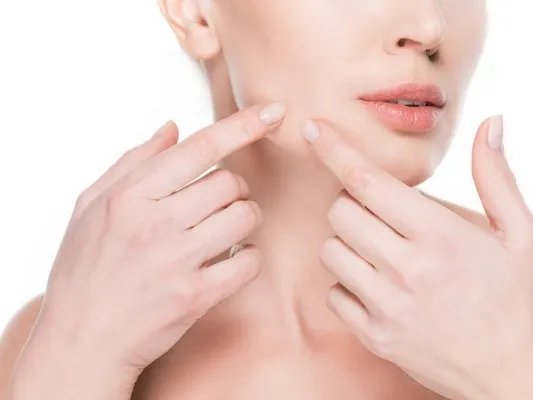 脸上出现白块的原因