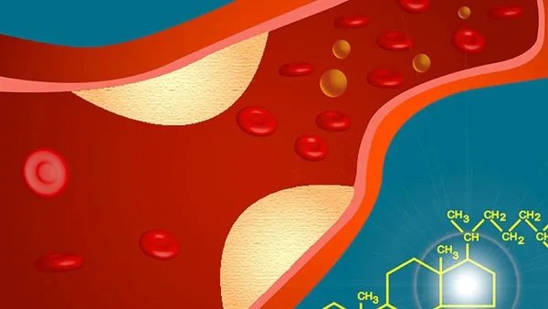 c反应蛋白高是怎么回事