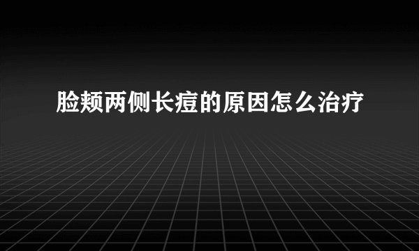 脸颊两侧长痘的原因怎么治疗