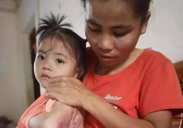 石家庄一女孩玩火碱重度烧伤,单亲妈妈泪崩,造成此悲剧的原因是什么?