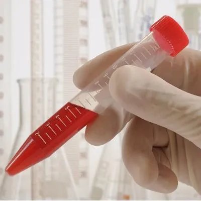 化验血沉高是怎么回事