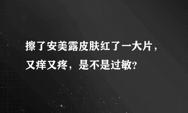 擦了安美露皮肤红了一大片，又痒又疼，是不是过敏？