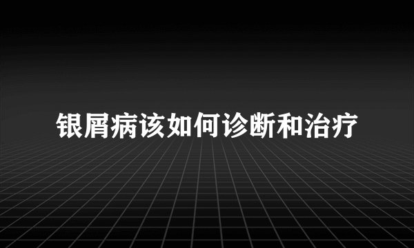 银屑病该如何诊断和治疗