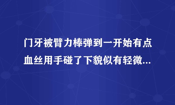 门牙被臂力棒弹到一开始有点血丝用手碰了下貌似有轻微...