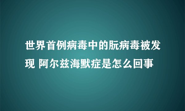 世界首例病毒中的朊病毒被发现 阿尔兹海默症是怎么回事
