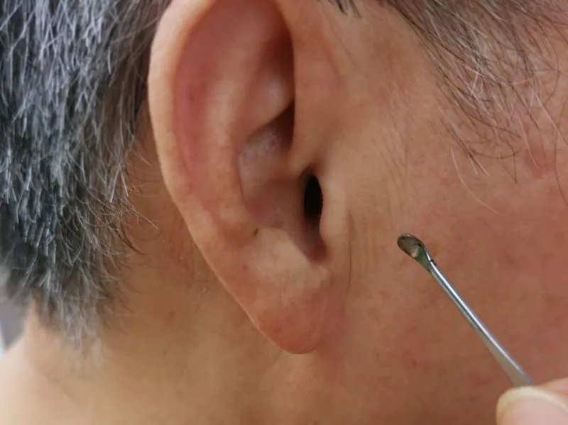 耳石症是怎么引起的