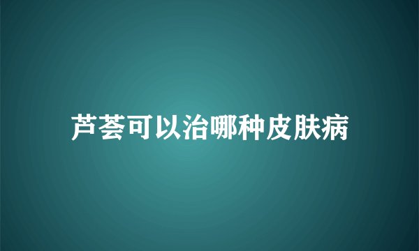芦荟可以治哪种皮肤病