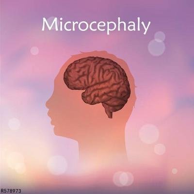 脑白质脱髓鞘改变是怎么回事