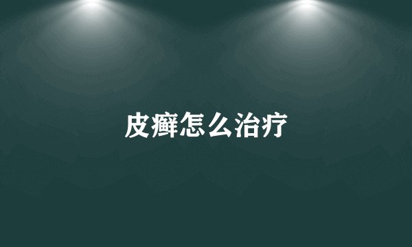 皮癣怎么治疗