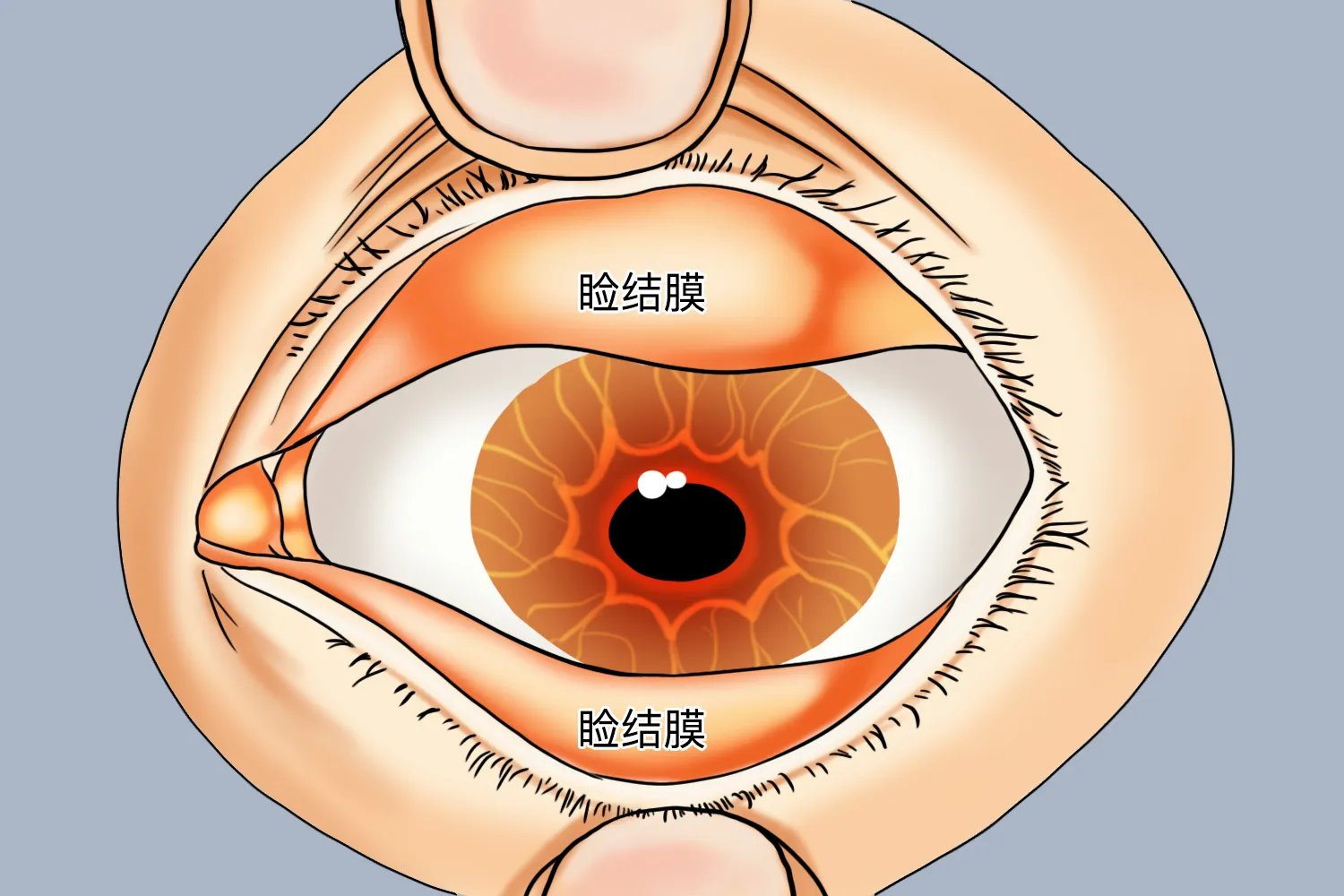眼睑内是哪里图片