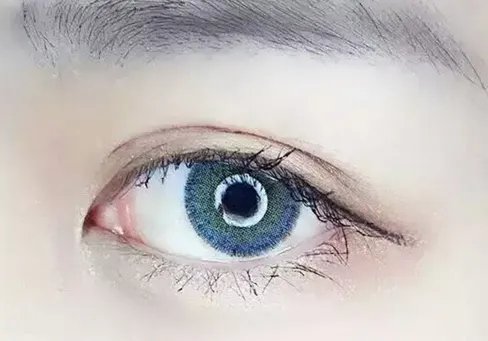 韩式去眼袋多久