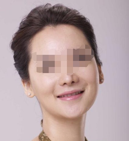 彩光嫩肤多少钱一次啊