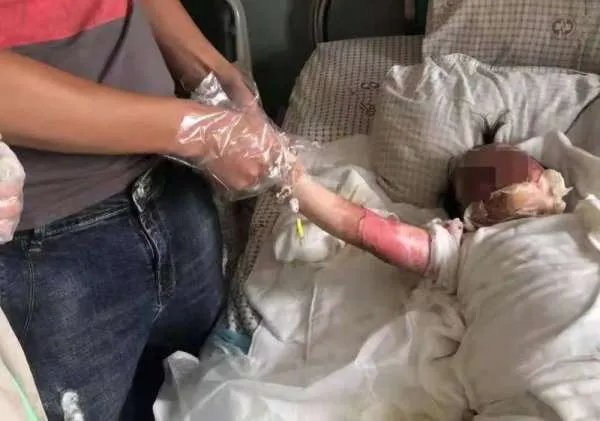 石家庄一女孩玩火碱重度烧伤,单亲妈妈泪崩,造成此悲剧的原因是什么?