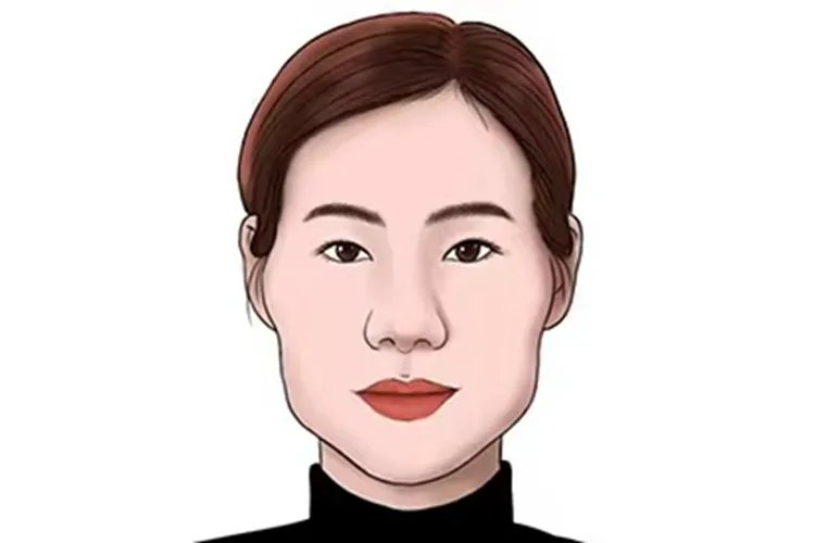 什么叫牙套脸图片