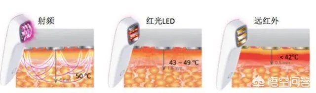 美容仪真的有返老还童的效果吗？