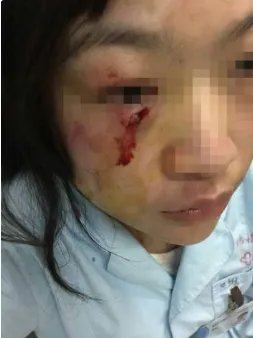 成都护士为什么被患者家属打伤？