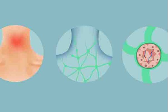 淋巴细胞百分比偏高是什么原因