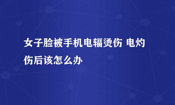 女子脸被手机电辐烫伤 电灼伤后该怎么办