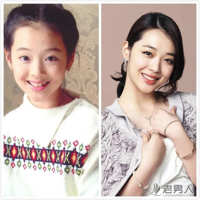 雪莉具荷拉诡异照片 雪莉整容前后照片